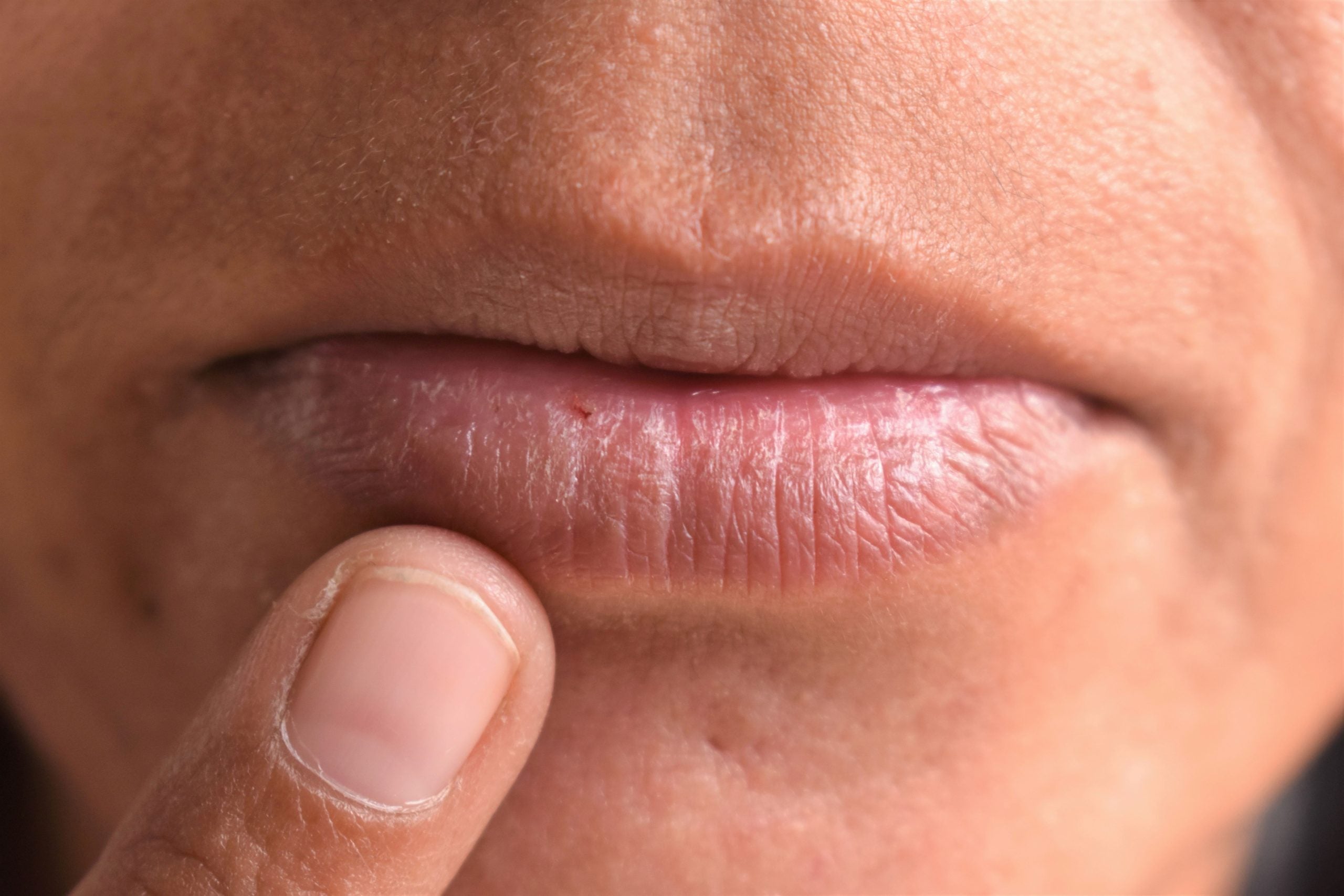 vitamin c deficiency on lips Doctor explains clinical signs of B12 (cobalamin) ashleycherryparke posted a con |