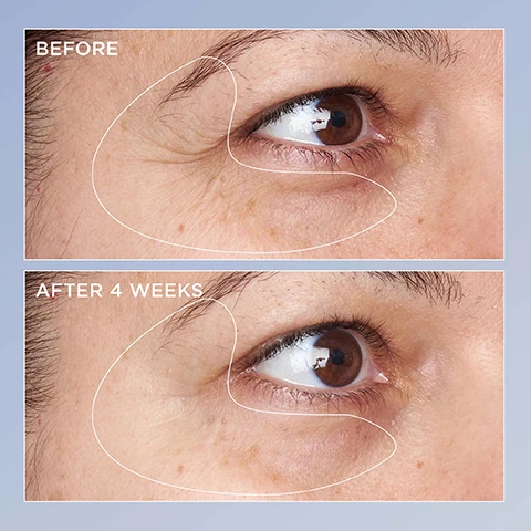 Image 1 - Image depicts two close-up views of an eye area showing skin changes; the top section labeled BEFORE shows wrinkles and dark circles, while the bottom section labeled AFTER 4 WEEKS shows smoother skin with reduced visibility of fine lines.
Image 2 - A bottle of Perricone MD Triple Retinol Renewal Eye Serum is centered on a warm brown background, with text indicating that 91% showed a significant reduction in under-eye dark circles, 88% showed a significant reduction in under-eye puffiness, and 83% saw minimized crows feet and wrinkles, along with footnotes about clinical studies.
Image 3 - A brown glass bottle of Perricone MD High Potency Triple Retinol Renewal Eye Serum is centered on a beige background, with white circular drops of liquid scattered around it and text stating minimizes under-eye darkness, diminishes crows feet & wrinkles, and promotes a smoother skin texture.
Image 4 - Image shows a brown bottle of Perricone MD High Potency Triple Retinol Renewal Eye Serum against a gradient background, with text listing benefits: R+ Triple Retinol Blend gently accelerates skin renewal, Q10 Coenzyme Q10 visibly diminishes uneven tone & wrinkles, and Beta-Carotene minimizes the look of uneven texture & redness.
Image 5 - A brown bottle of Perricone MD eye serum is shown with a white cream-like swirl beside it, and five stars above the text that reads My eye area looks very smooth, supple & more youthful. —Heather S.
