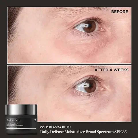 Image 1 - A side-by-side comparison of an eye region showing before and after effects of a skincare product, with visible text labeling the first image BEFORE and the second image AFTER 4 WEEKS, along with a product jar and text that reads Perricone MD Cold Plasma Plus+ Daily Defense Moisturizer Broad Spectrum SPF 35.
Image 2 - A jar of Perricone MD Cold Plasma Plus+ Daily Defense Moisturizer, with a light green cream visible inside, accompanied by text that states 93% showed significant improvement in skin hydration, texture & tone*, 90% showed significant improvement in skin radiance & brightness*, and 87% saw a significant reduction in wrinkles*, with a note about the clinical study at the bottom. Image 3 - MINERAL-BASED SUNSCREEN Protects against future sun damage VITAMIN C ESTER Corrects visible discoloration, uneven tone & redness Perricone MD Cold Plasma Plus+ Daily Defense Moisturizer Broad Spectrum SPF 35 29 Cu COPPER TRIPEPTIDE Prevents visible signs of photoaging Image 4 - "My skin feels hydrated, pores look smaller, fine lines have noticeably decreased and overall firmness has improved." - Stacey A. Perricone MD Cold Plasma Plus+ Daily Defense Moisturizer Broad Spectrum SPF 35 Image 5 - YOUR COLD PLASMA PLUS+ ROUTINE. Moisturizer Treat Perricone MD Cold Plasma Plus+ Advanced Serum Concentrate ل Perricone MD Cold Plasma Plus+ Daily Defense Moisturizer Read Spectrum SPF 35 Eye Perricone MD Cold Plasma Plus+ Eye