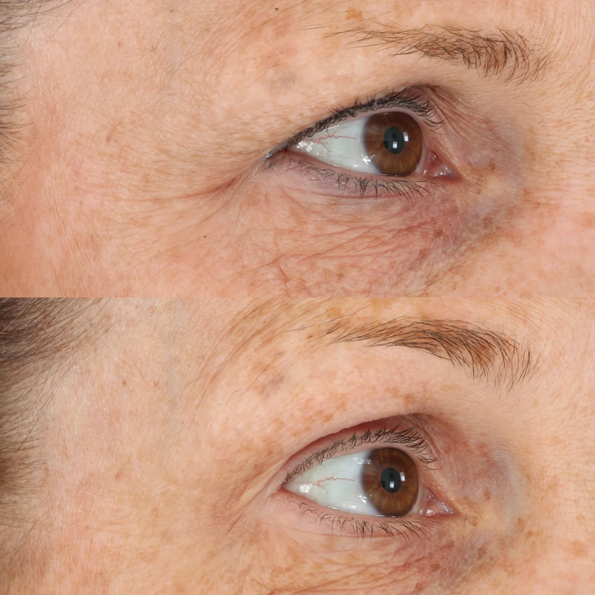 Essential Fx Acyl-Glutathione Eyelid Lift Serum