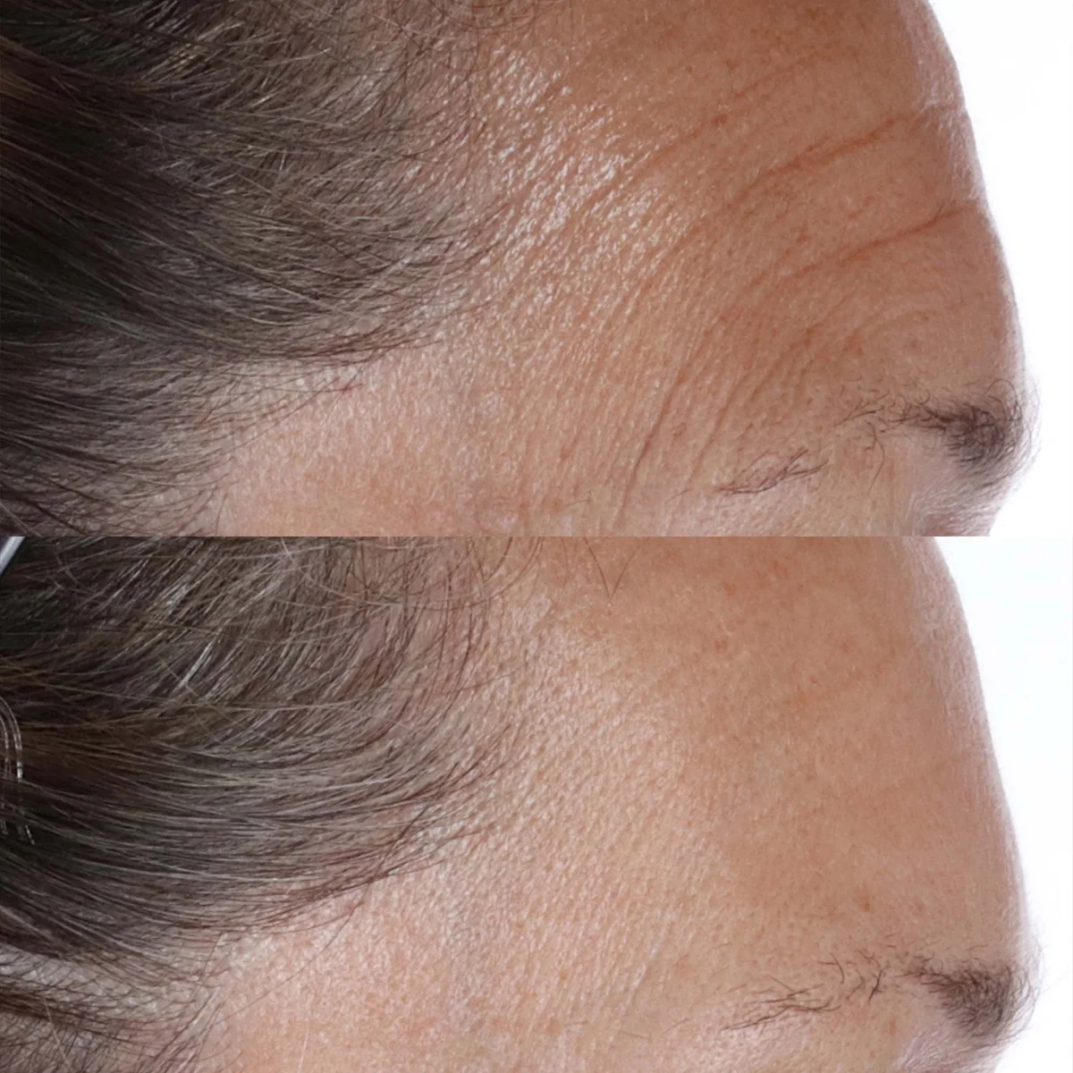 glutathione and alopecia Can Help Hair Loss? Exploring the Connection Between This Antioxidant Hair Health Glutathione : Pigment International