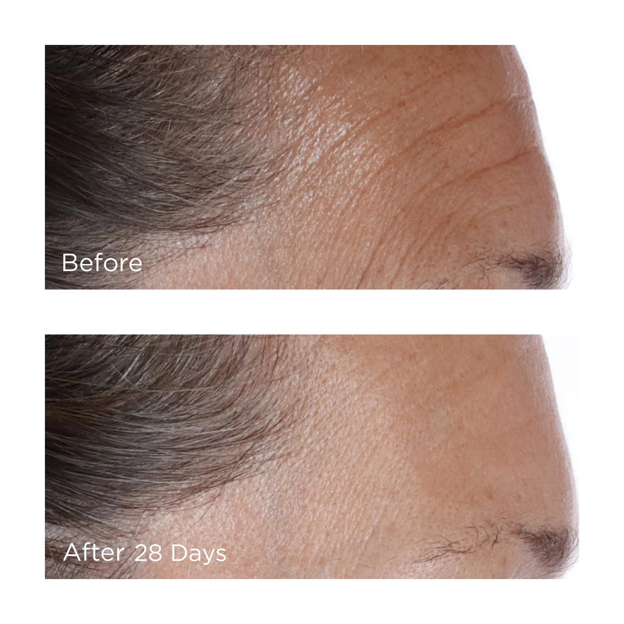 Image of the essential FX acyl-glutathione collection